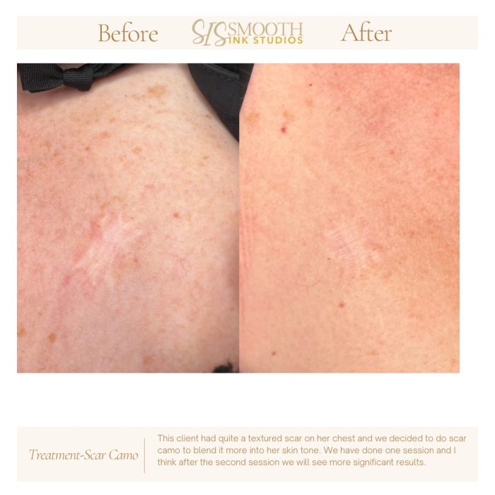 Neutral Before and After Neutral Before and After