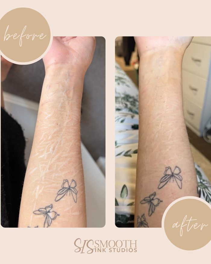 ISR Before and After