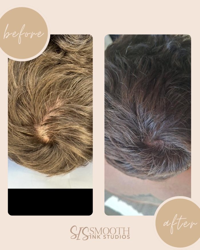 NUE STRAND Before and After