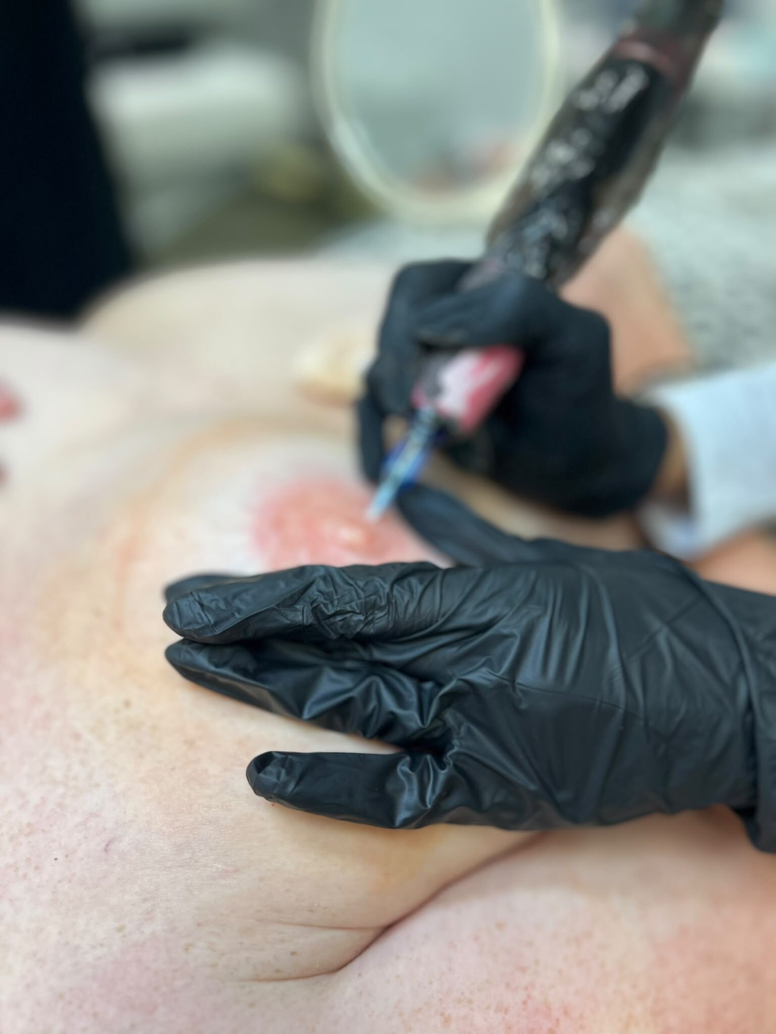 d11eacaa-4dcd-49e2-8b4c-68ea3b6bd44c Nipple Restoration